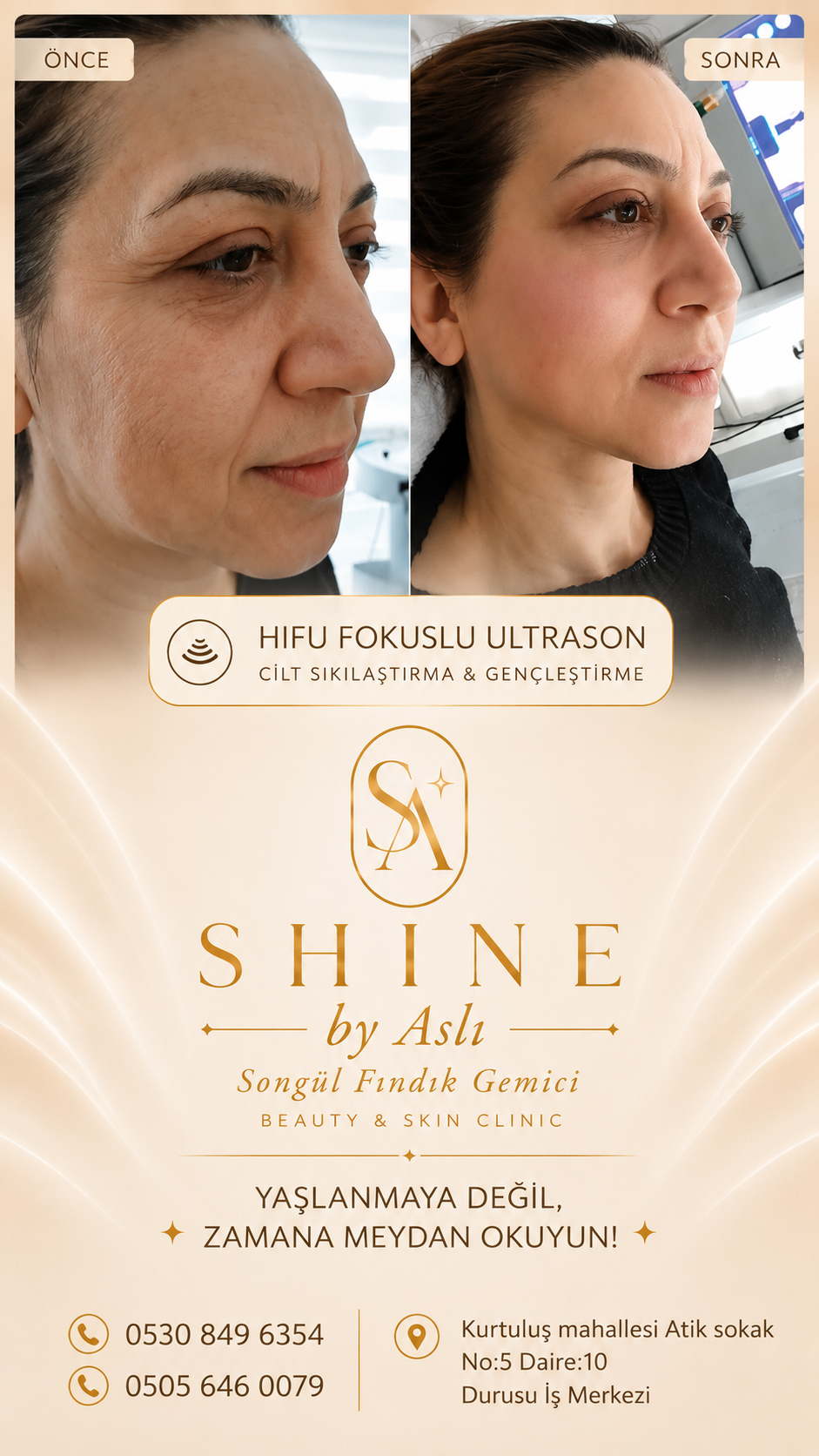 Shine By Beauty galeri 4