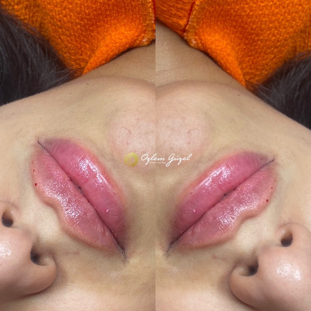 Özlem Güzel Beauty galeri 3